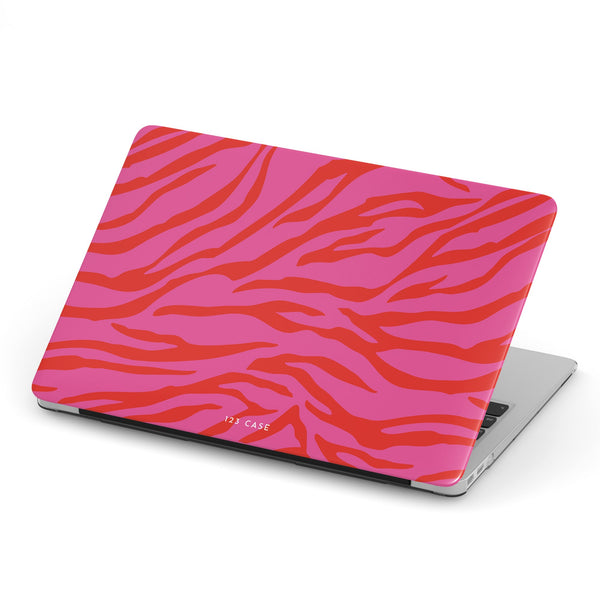 Trendy Zebra Macbook Case